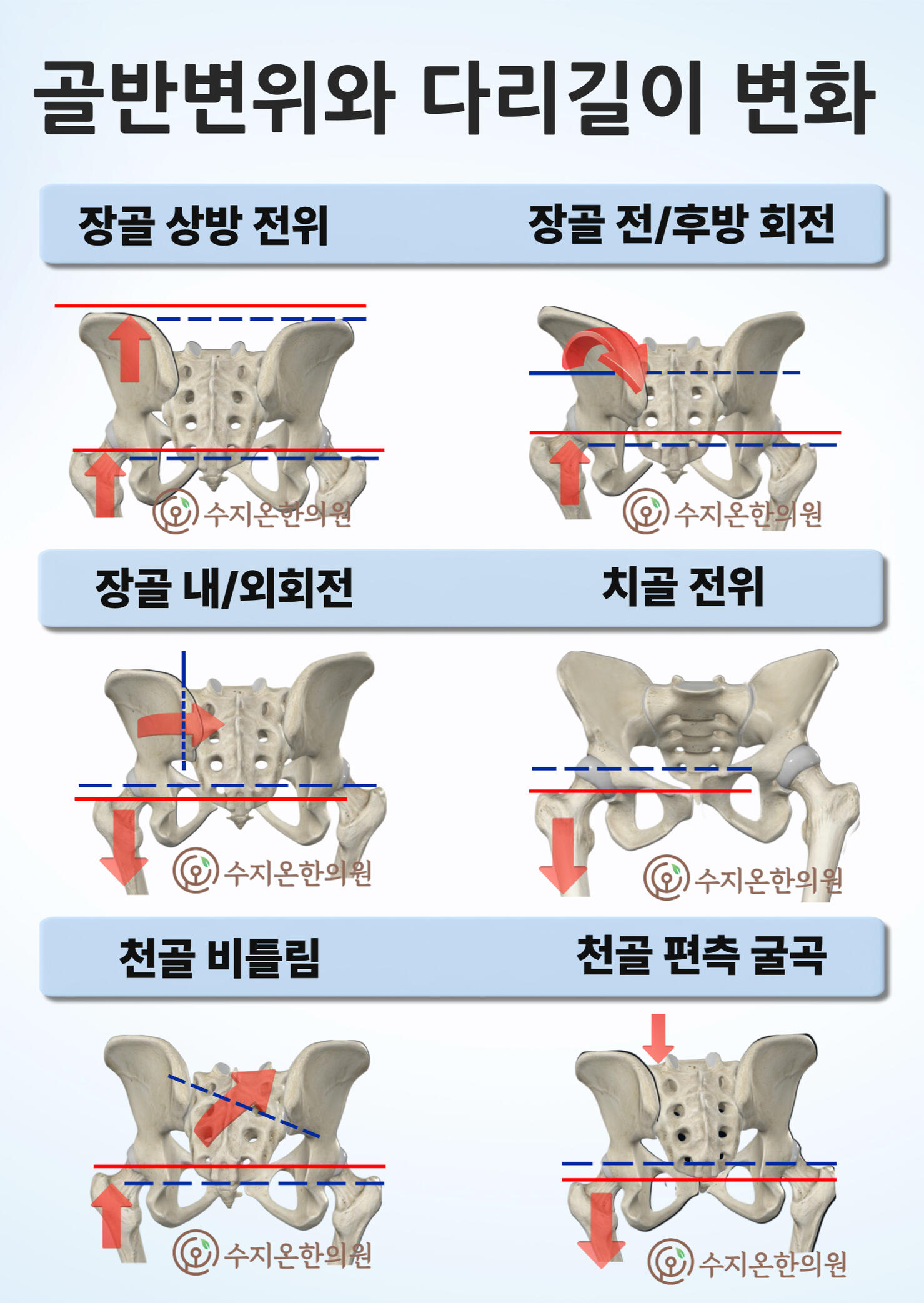 두개추나
